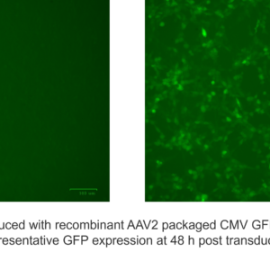 aav cmv gfp