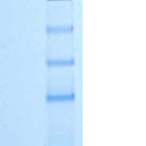 human erbb2 / her2 protein fc tag or tag free