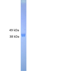 herpes simplex virus (hsv) (serotype 1) gd protein (his tag)