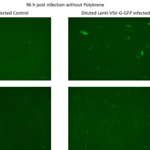 lentivirus gfp control (cmv promoter)
