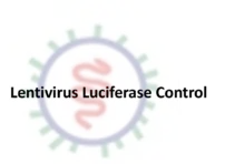 lentivirus luciferase control (cmv promoter) lentivirus luciferase control (cmv promoter)