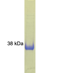 sars cov 2 spike receptor binding domain (rbd) (his tag)