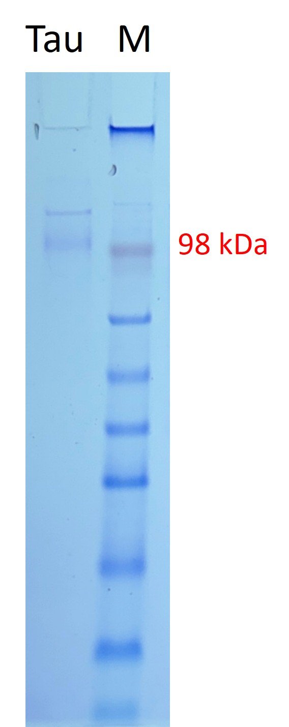 human tau protein, myc and his tags human tau protein, myc and his tags