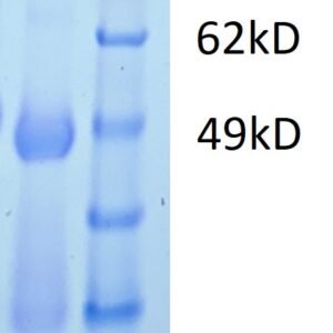 ebola bundibugyo trimeric gp protein –twinstrep and his tags