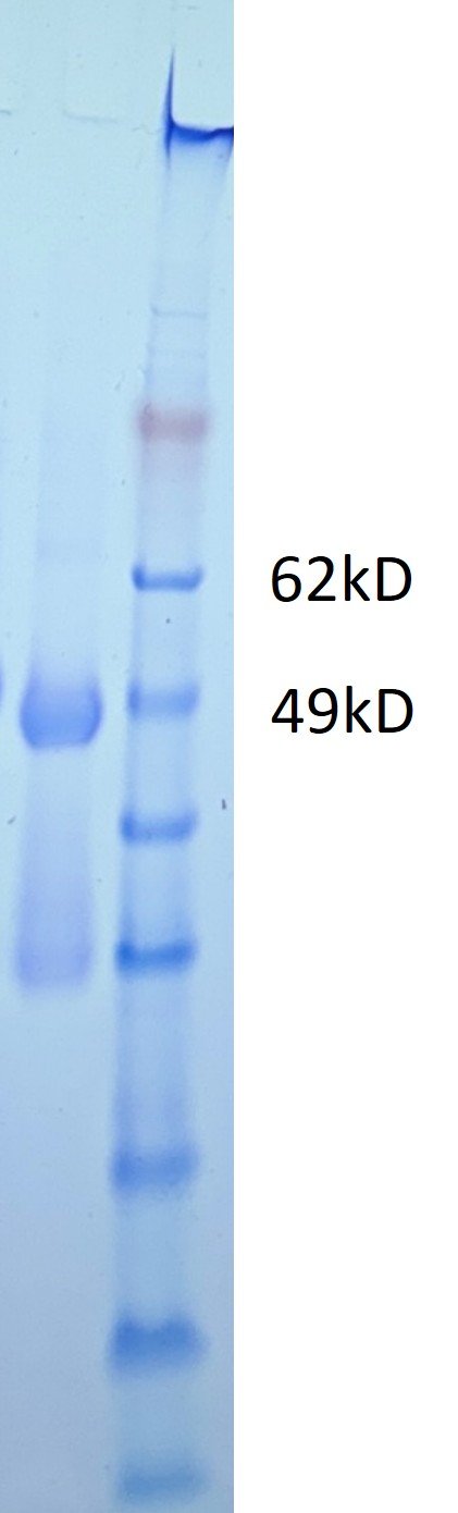 ebola bundibugyo trimeric gp protein –twinstrep and his tags ebola bundibugyo trimeric gp protein –twinstrep and his tags