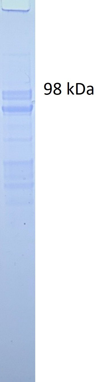 Influenza A Nucleoprotein (NP) protein (H3N2 strain) - Image 2