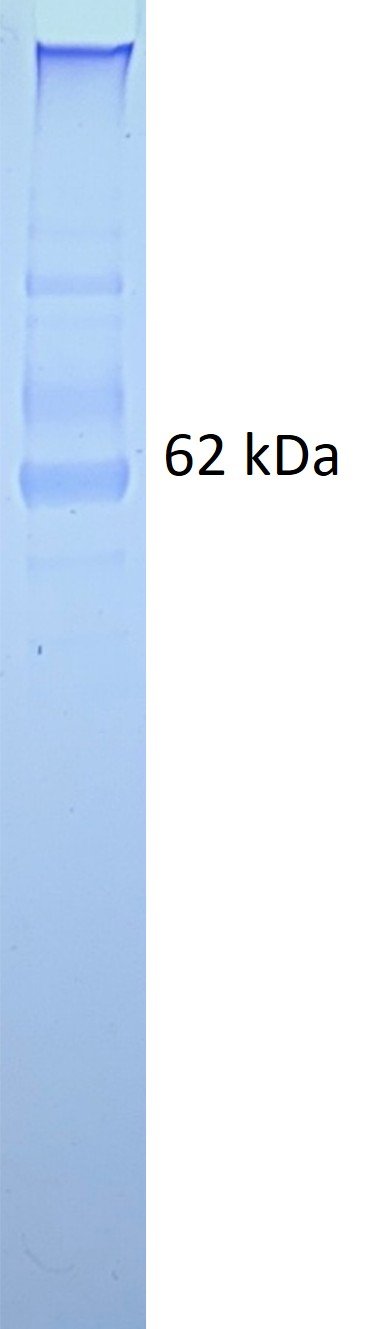 Human Cytomegalovirus (HCMV) Trimeric Glycoprotein B (gB) protein - Image 2
