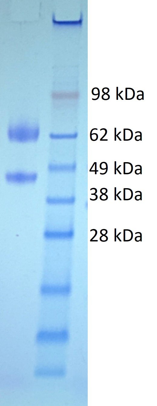 HMPV Glycoprotein (subtype A1), His and Fc tags - Image 2