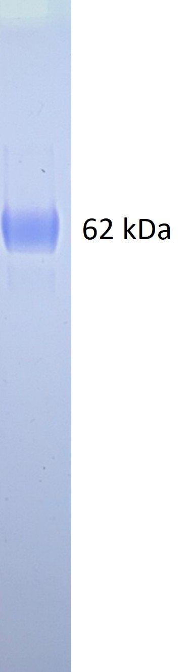 HMPV Glycoprotein (subtype B1), His and Fc tags - Image 2