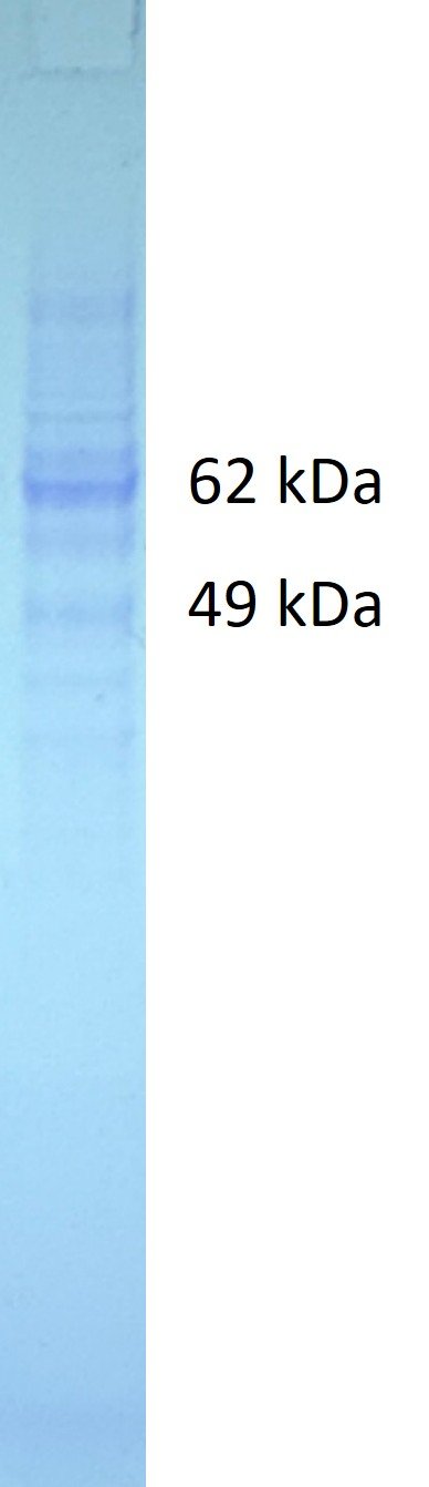 Human YWHAG protein, Myc and Fc tags - Image 2